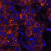 Anti-PAI1 Antibody