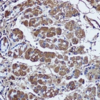 Anti-SFRP1 Antibody