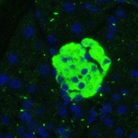 Anti-SARP3 Antibody