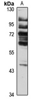 SGK2 Rabbit Polyclonal Antibody