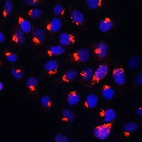 Anti-SMS1 Antibody