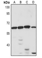SP-lyase 1 Rabbit Polyclonal Antibody