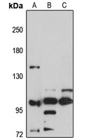 SH3BP4 Antibody