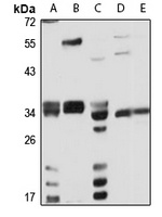 SIRT5 Antibody