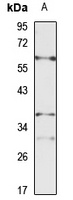 NTCP Rabbit Polyclonal Antibody