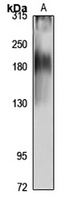 NKCC1 Rabbit Polyclonal Antibody