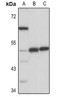 MCT1 Rabbit Polyclonal Antibody