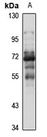 SLC16A10 Rabbit Polyclonal Antibody