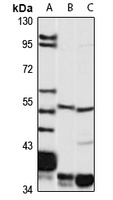 VMAT2 Rabbit Polyclonal Antibody