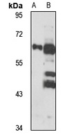 NCKX4 Rabbit Polyclonal Antibody