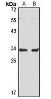 UCP5 Rabbit Polyclonal Antibody