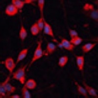 Anti-SLC25A19 Antibody