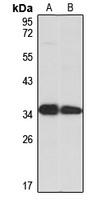 UCP4 Rabbit Polyclonal Antibody