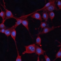 UCP4 Rabbit Polyclonal Antibody