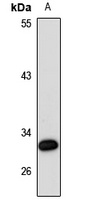 SLC25A38 Antibody