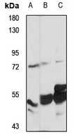 FATP4 Rabbit Polyclonal Antibody
