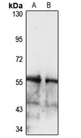 SLC2A9 Rabbit Polyclonal Antibody
