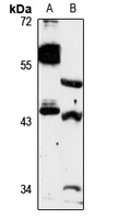 ZNT4 Rabbit Polyclonal Antibody