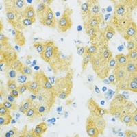 Anti-SLC37A4 Antibody