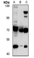 SLC39A12 Antibody