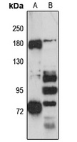 SLC4A10 Rabbit Polyclonal Antibody