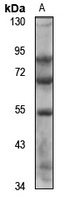 SLC5A12 Antibody