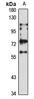 SMVT Rabbit Polyclonal Antibody