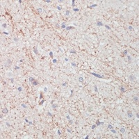 Anti-Dopamine Transporter Antibody