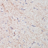 Dopamine Transporter antibody