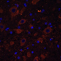Anti-Dopamine Transporter Antibody