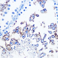 Anti-SERT Antibody