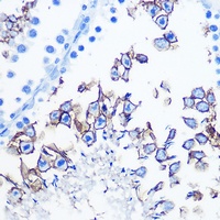 Serotonin Transporter antibody