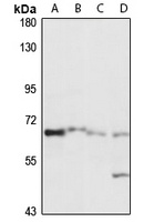 SLC7A1 Rabbit Polyclonal Antibody