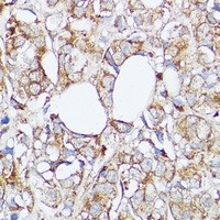 SLC7A2 antibody