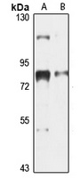 OATP-F Rabbit Polyclonal Antibody