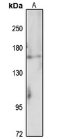 SLIT2 Rabbit Polyclonal Antibody