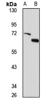 SMAD1/5/9 Rabbit Polyclonal Antibody