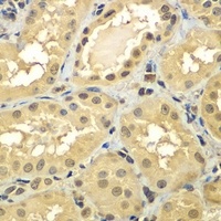 SMAD2/3 Antibody