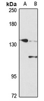 SMC2 Rabbit Polyclonal Antibody