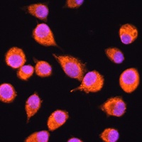 Anti-N-SMase3 Antibody