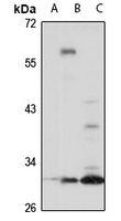 SNAI3 Rabbit Polyclonal Antibody