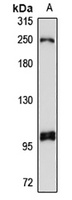 HELIC2 Rabbit Polyclonal Antibody