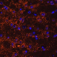 SNX13 Rabbit Polyclonal Antibody