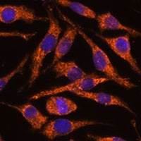 Anti-SNX15 Antibody