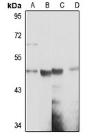 SNX5 Rabbit Polyclonal Antibody