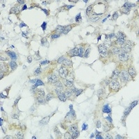 Anti-SOCS5 Antibody