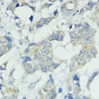 SOCS5 antibody