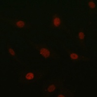 Anti-SOX10 Antibody