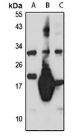 Sp17 Rabbit Polyclonal Antibody