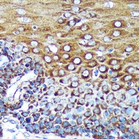 Anti-Cytospin-A Antibody
